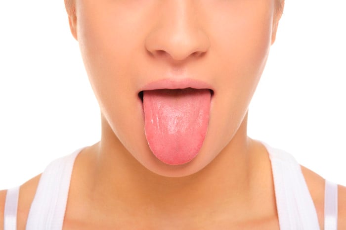 white tongue coating